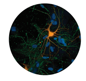 SynFyre Neuronal Cells Satined using ICC