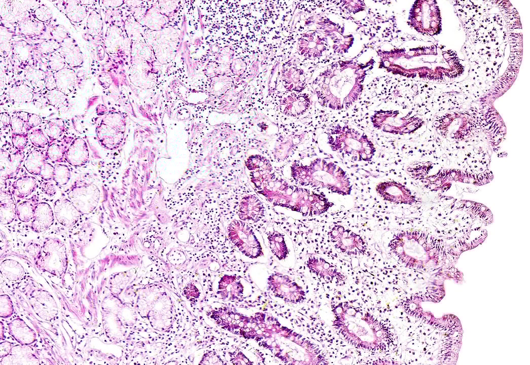 Microscope image of human tissue 