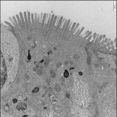 IBD model villi