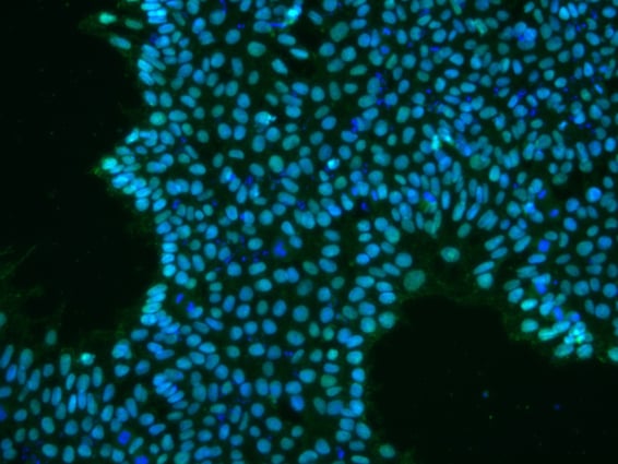 Fluorescent microscope image of stem cells