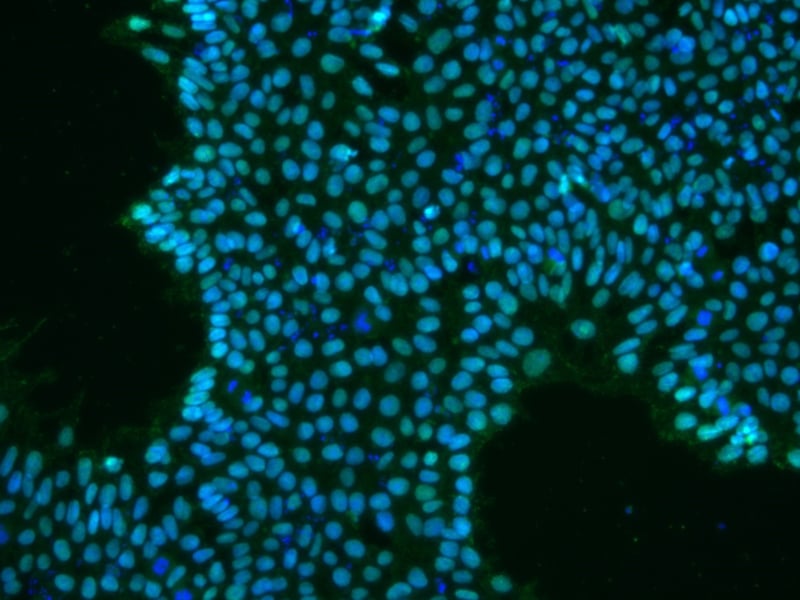 Image of iPSCs stained for DNA and internal markers of pluripotency at REPROCELL