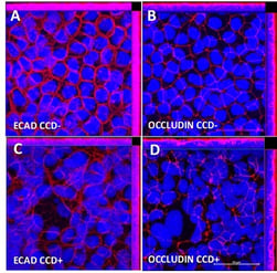 Image showing Alvetex has higher expression of junctional complexes than caco 2 models