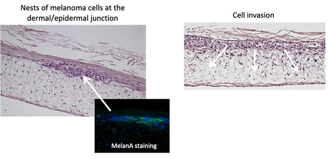 Inclusion of Mucus Goblet cells.png