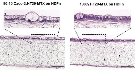 Inclusion of Mucus Goblet cells