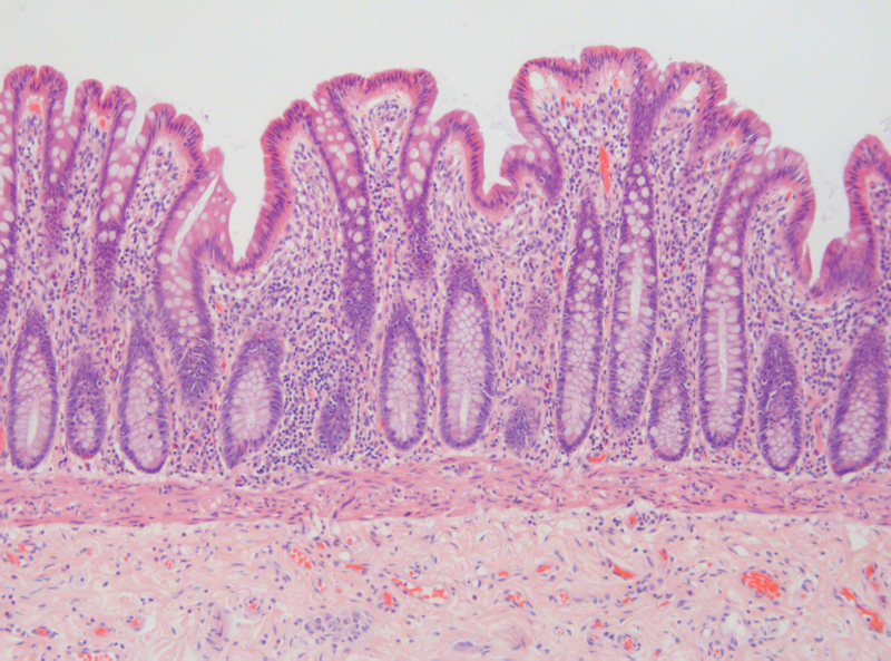 Healthy Intestinal Epithelium Histology