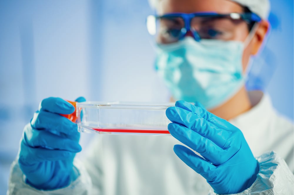 Lab Scientist holding a flask with cells
