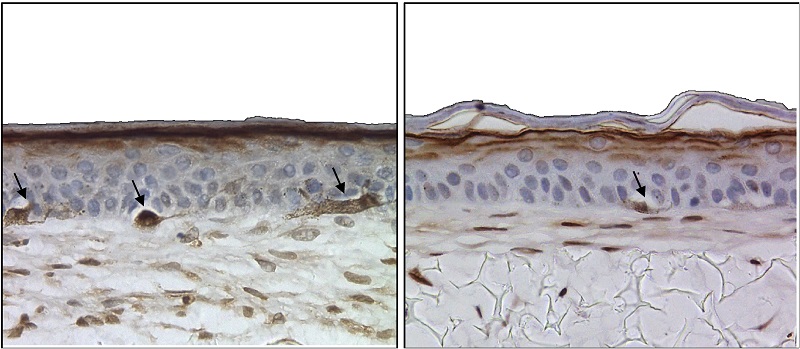 Melnocytes s100