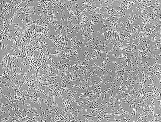 Microscopic image of bone marrow derived MSCs cultured with StemFit For MSCs