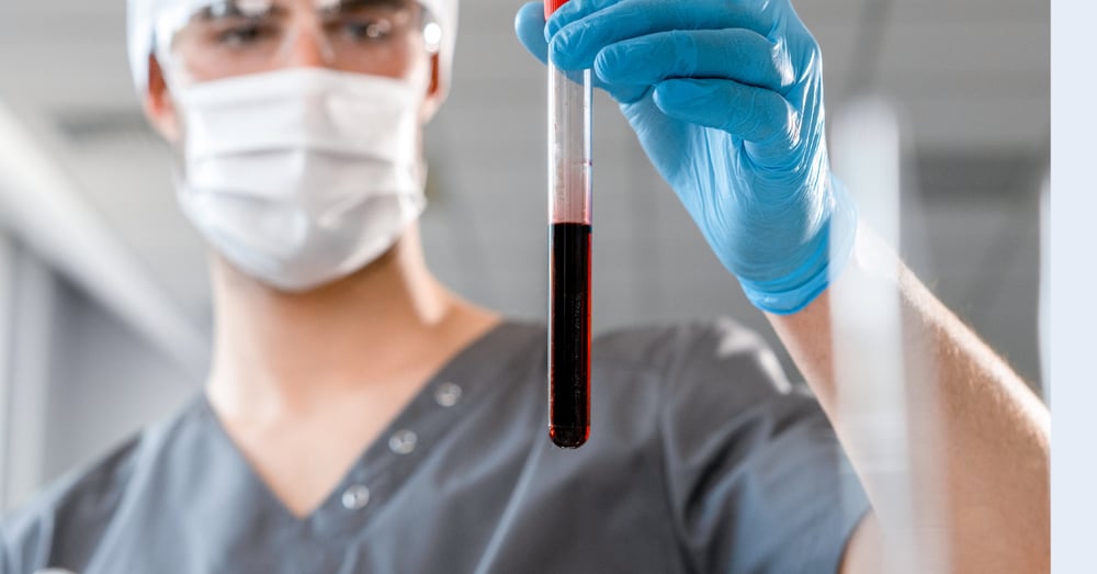 What to Look for in a Global Central Lab Partner for Clinical Trials