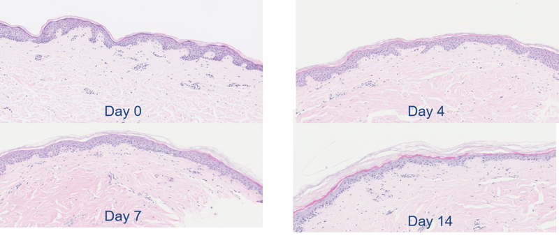 Normal Skin Histopathology Maintained for up to One Week in Culture