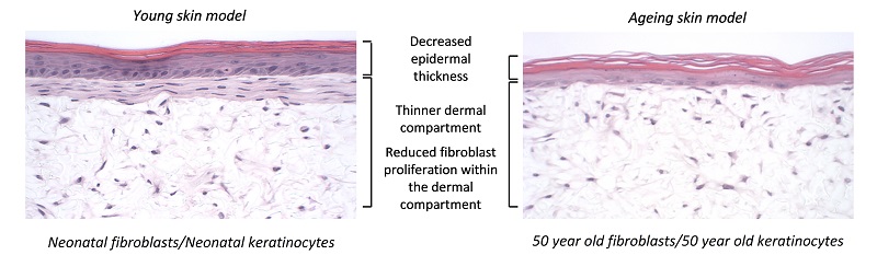 Novel ageing skin model developed using keratinocytes and fibroblasts from the same 50-year-old female donor