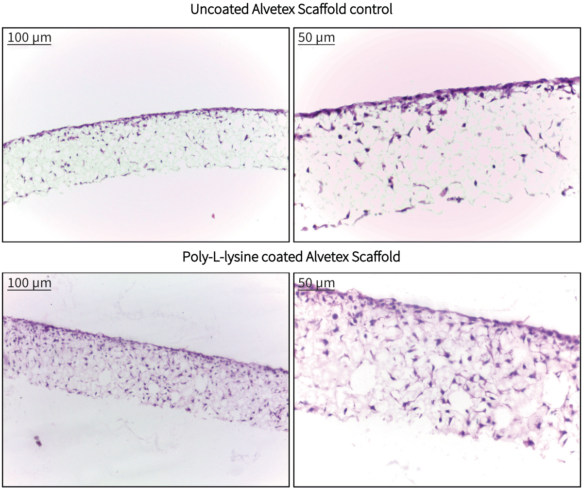 Alvetex Scaffold Protocol PolyD or Llysine Coating