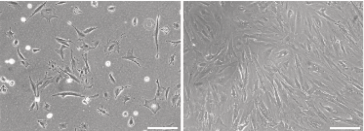 Alvetex Scaffold Protocol: Human Colon Fibroblastic CCD-18co Cell Line ...