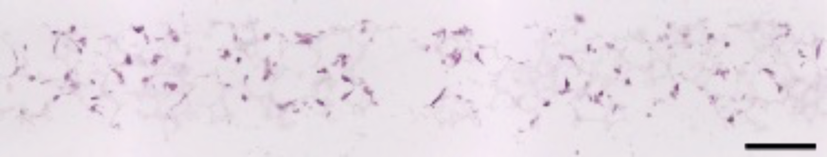 Alvetex Scaffold Protocol: Human Colon Fibroblastic CCD-18co Cell Line ...