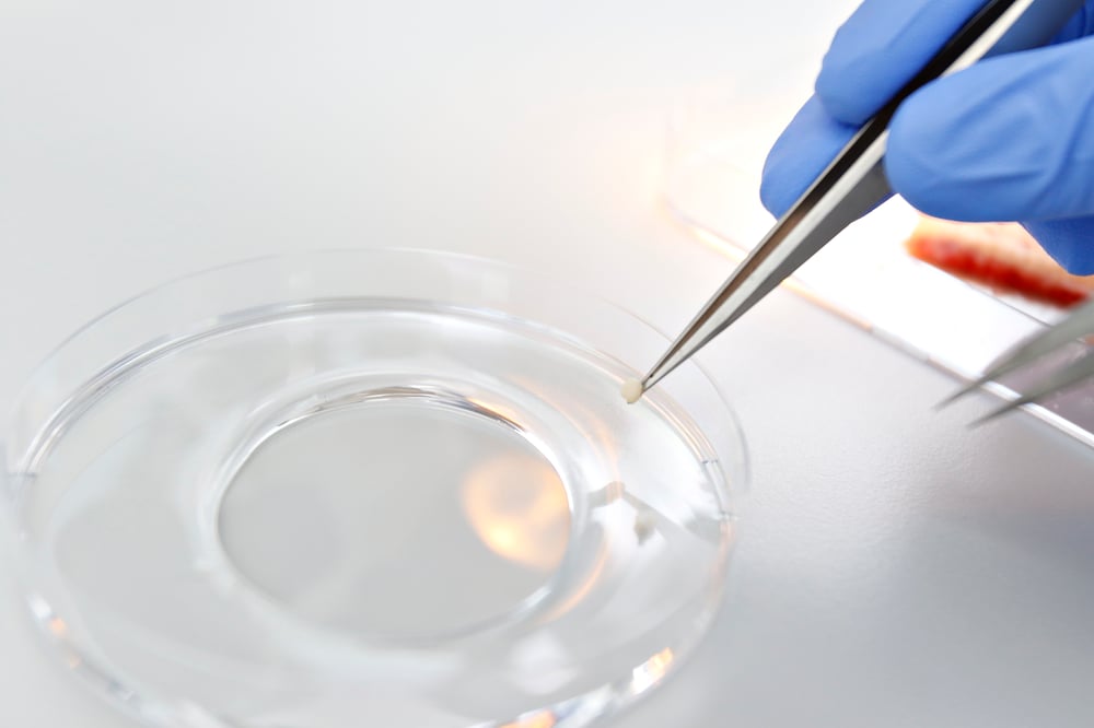Psoriasis & Atopic Dermatitis Research And Assays