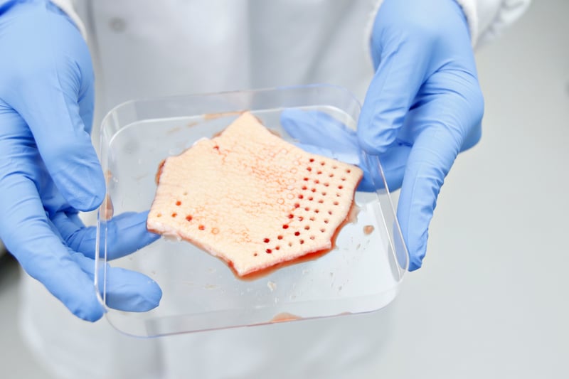 A person wearing gloves holding a plastic dish containing human skin with punch biopsies taken out of it.