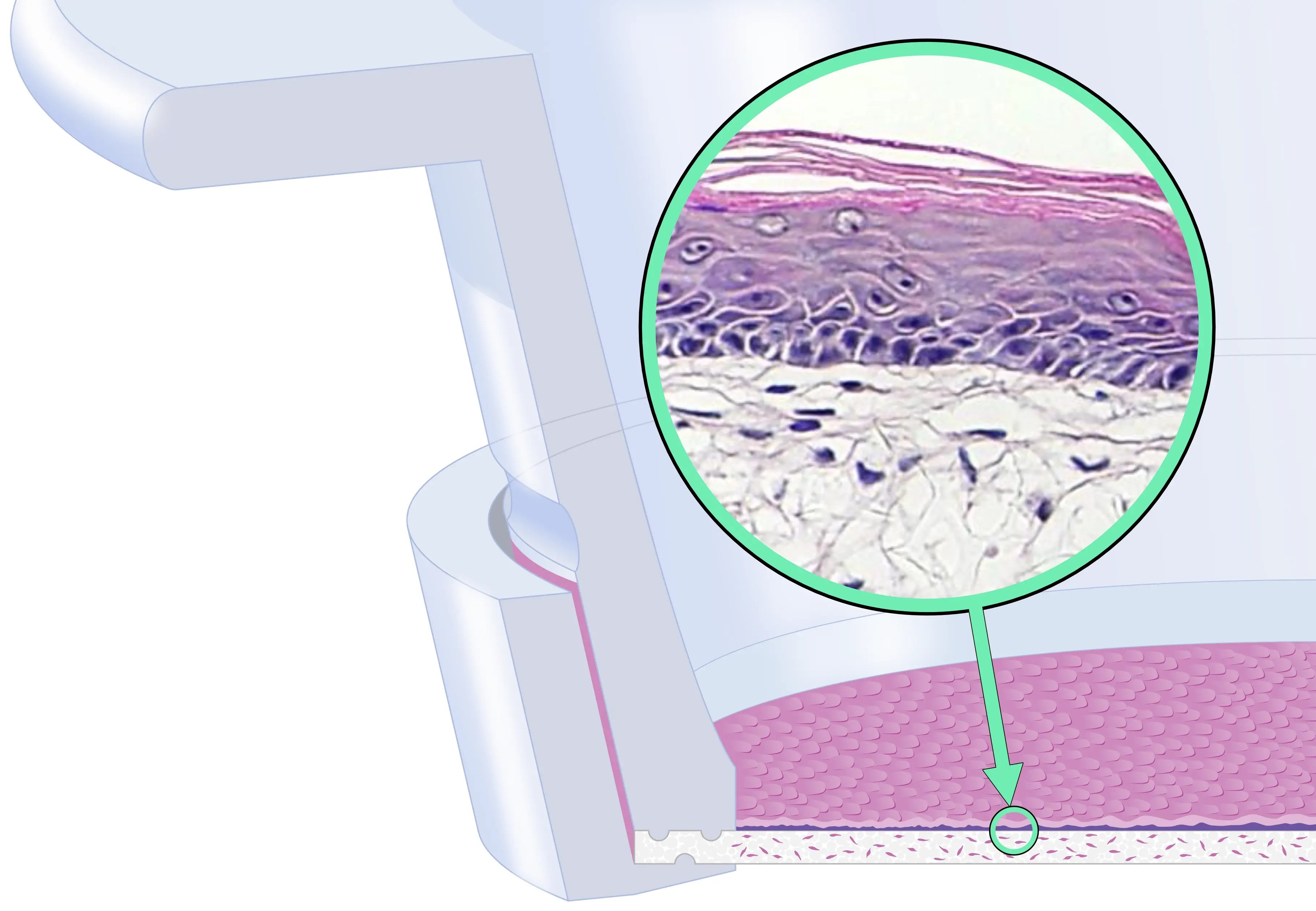 REPROSKIN in insert cutaway cartoon draft 4