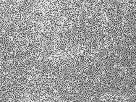 Off-the-shelf iPSC lines