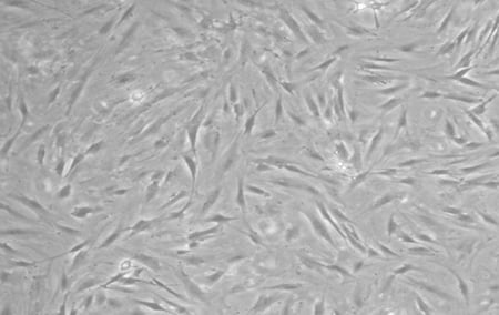 SK-007 fibroblasts in culture