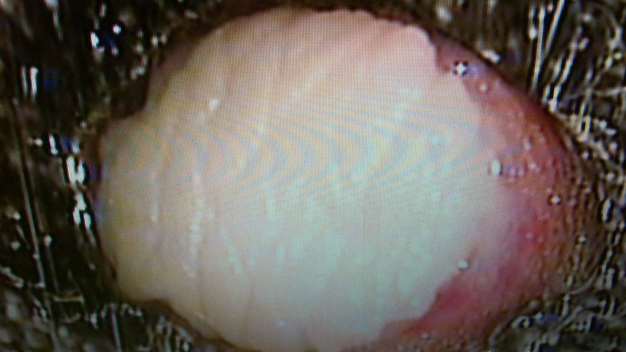 Skin biopsy-1