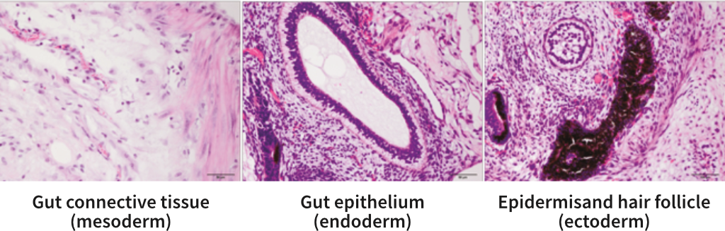 StemRNA hiPSCs differentiate into all three germ layers