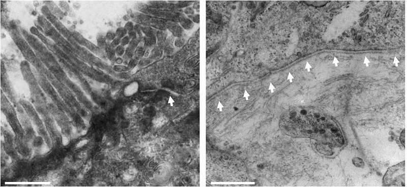 TEM analysis of alvetex model of human intestine