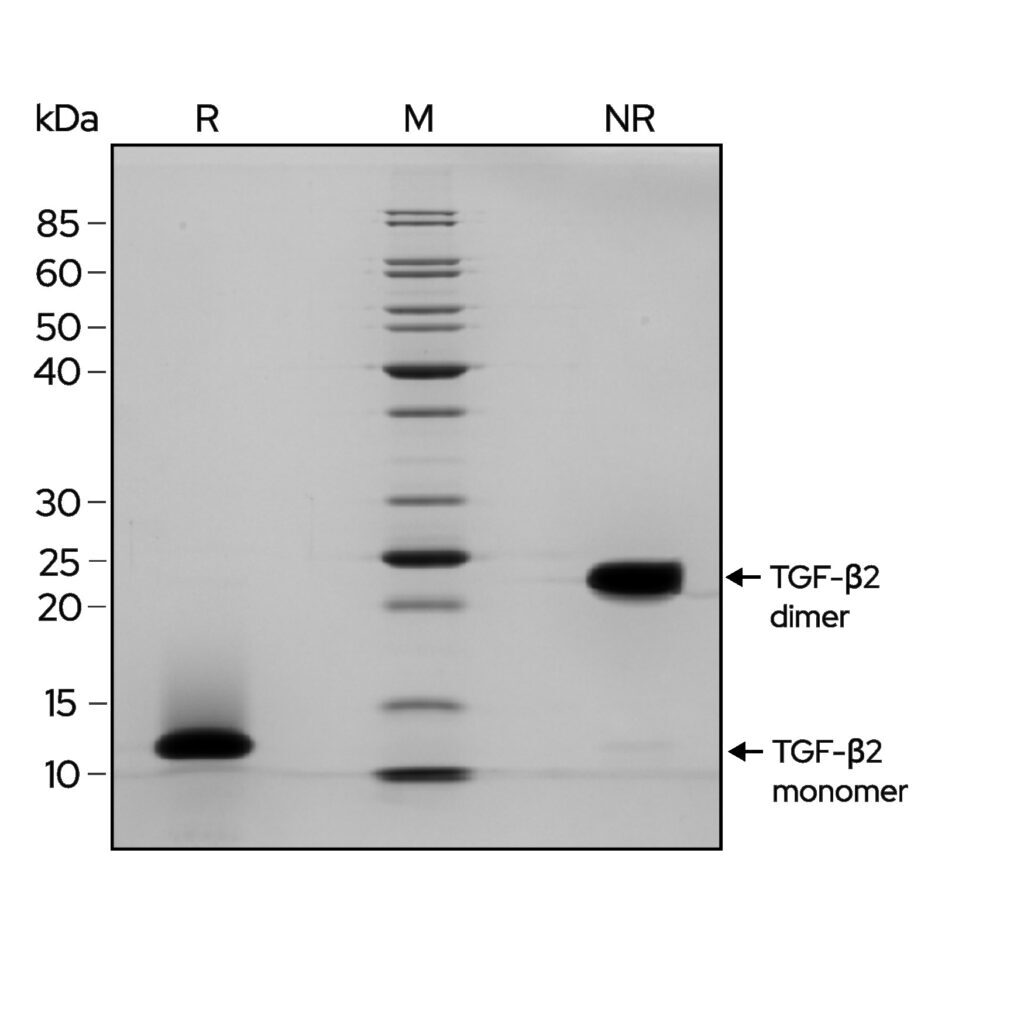 TGFb2-gel-image-1-1024x1024
