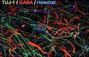 TUJ1GABBAHoechst