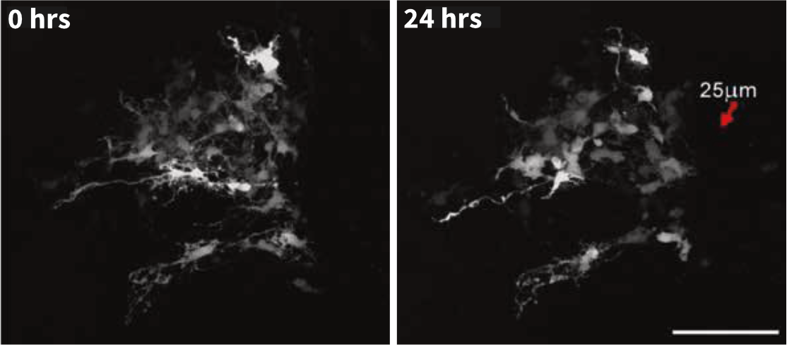 Time lapse imaging of spinal cord tissue slice maintained on Alvetex Strata