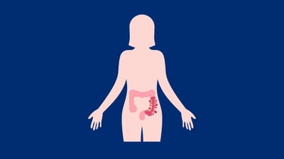 Preserving the Microenvironment-Advances in Ex Vivo Colonic Tissue Culture for IBD Drug Discovery