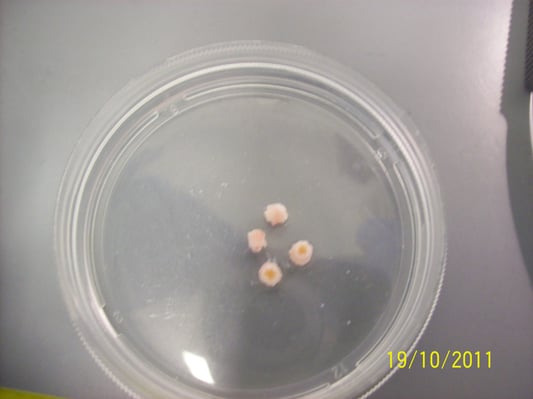 Ureter