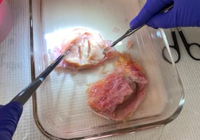Uterus-1