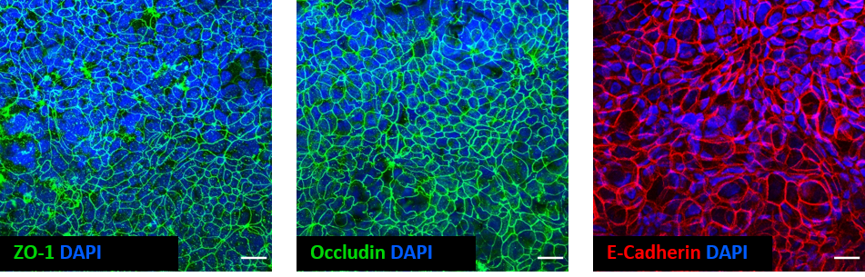 Whole-mount immunostaining of a Caco-2 fibroblast co-culture model of the intestinal mucosa created using 12-well Alvetex Scaffold as a platform for cell culture.