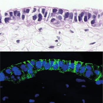 alvetex-caco2-ccd18-int-mucosaCaco2 cells co-cultured with CCD-18co fibroblasts in Alvetex Scaffold, forming a full-thickness model of intestinal mucosa.