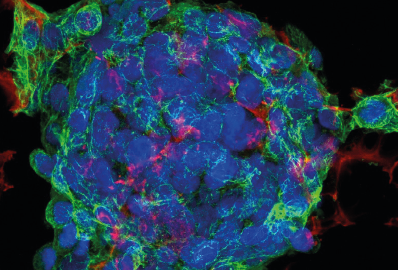 Cells under a fluorescent microscope