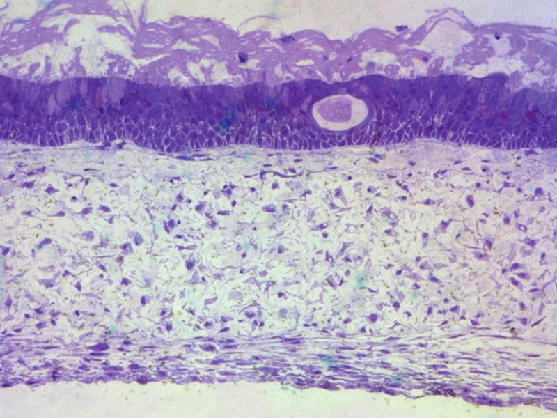 Alvetex lung mucosa model 