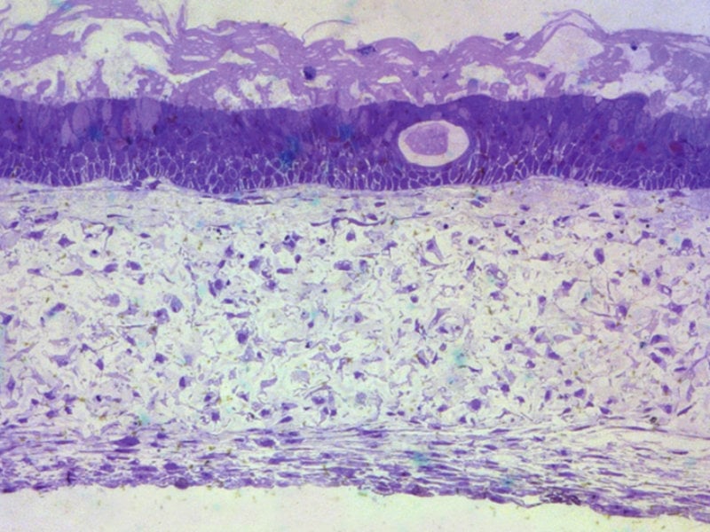 alvetex-lung-mucosa-model