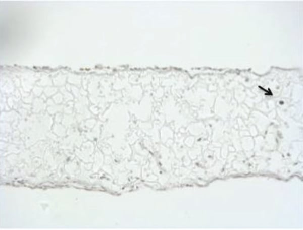 Tunel staining of OCY454 in Alvetex Scaffold. 