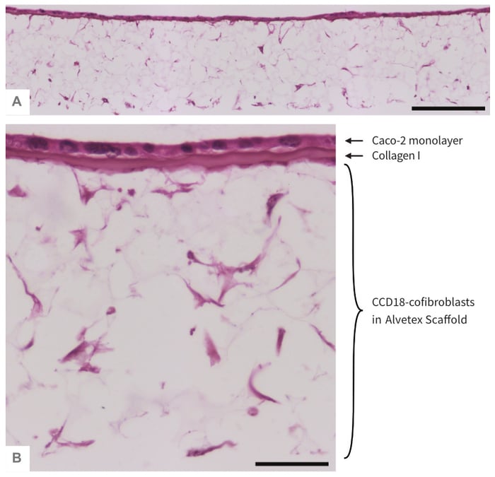  Co-culture ofCaco-2 cells and CCD-18 fibroblasts separated by a Collagen I layer in Alvetex Scaffold.