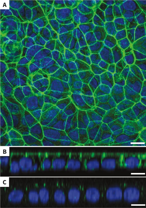 The morphology of MDCK cells in uncoated Alvetex Scaffold resembles in vivo kidney tubular structures. - part 1