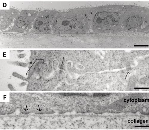 The morphology of MDCK cells in uncoated Alvetex Scaffold resembles in vivo kidney tubular structures. - Part 2