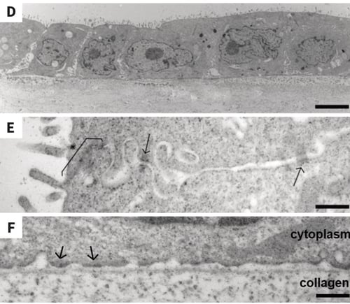 The morphology of MDCK cells in uncoated Alvetex Scaffold resembles in vivo kidney tubular structures. - Part 2
