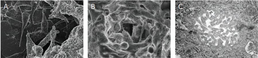 HepG2 form 3D structures when grown in Alvetex Scaffold.