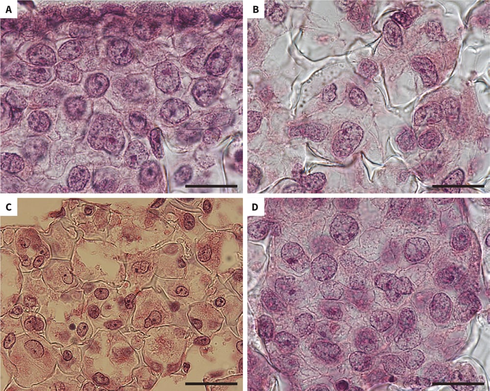 Growth of human pluripotent stem cells in Alvetex Scaffold.