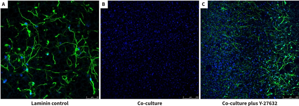 Inhibition and recovery of neurite outgrowth in neuron / glial 3D co-cultures using Alvetex Scaffold.