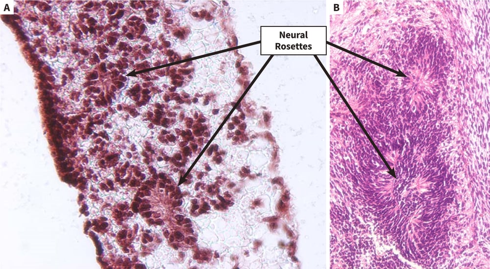 Differentiation of human pluripotent stem cells into neural derivatives in Alvetex Scaffold (A and B).