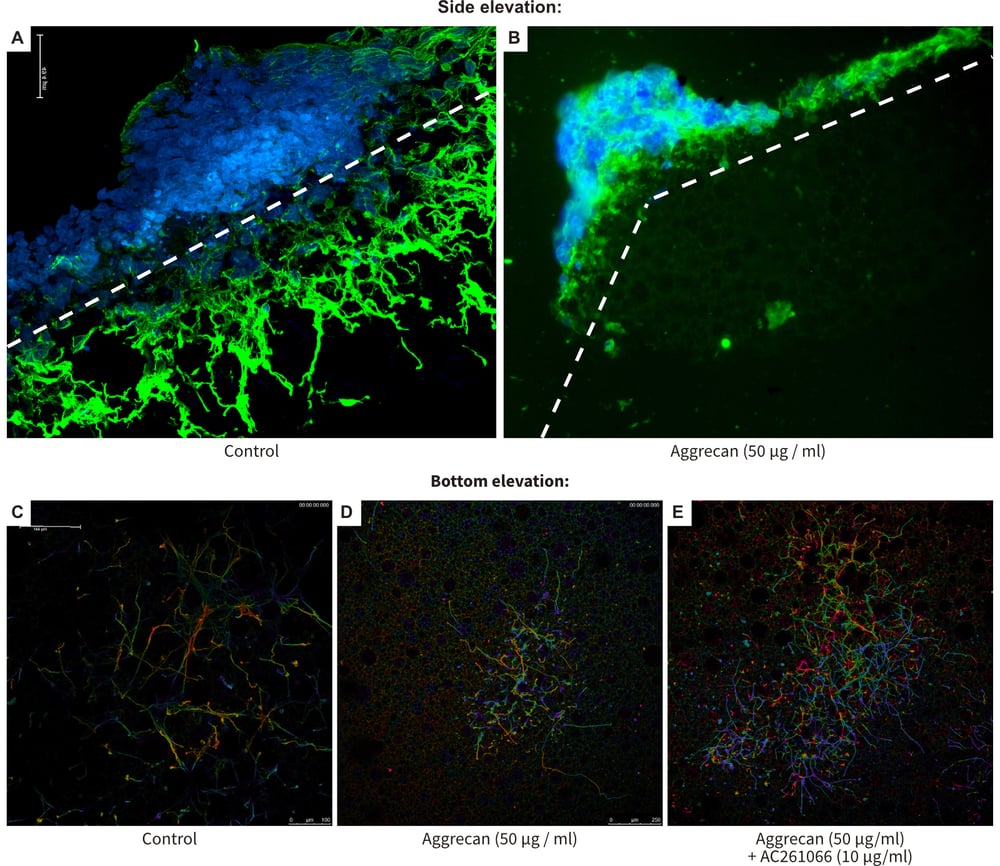 Recovery from neurite inhibition in a novel 3D model using Alvetex Scaffold.