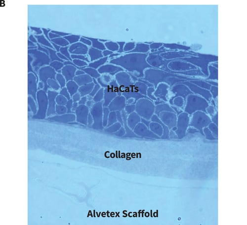 Organotypic co-culture and collagen gel set-ups (B).