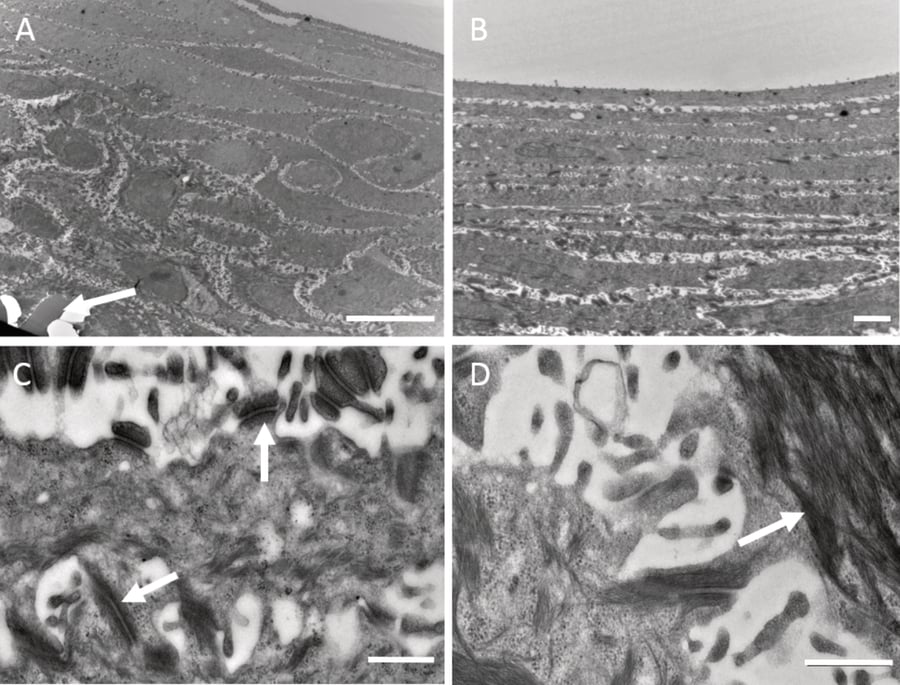 Ultra-structural characterisation of HaCaT cells on Alvetex Scaffold.