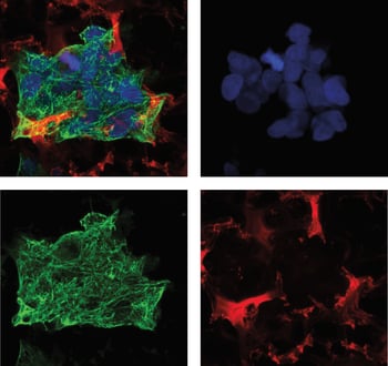 Microscopy Imaging Techniques and Alvetex Scaffold